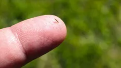 A splinter in your finger? Here's how to easily and safely remove it.